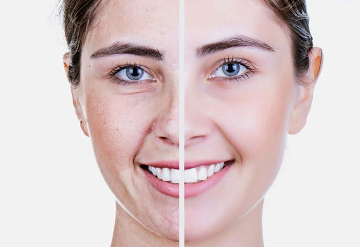 Áp dụng 6 cách trẻ hóa da vùng mắt sau để giúp bản thân trông trẻ trung hơn