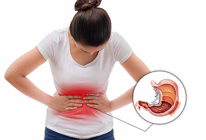 6 dấu hiệu cho thấy bạn có thể đang bị đau dạ dày
