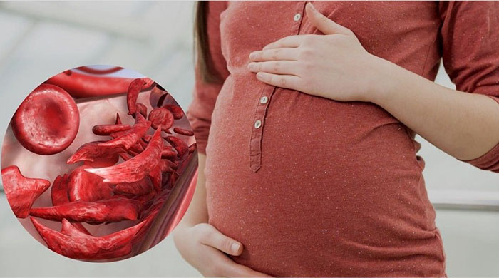 Những điều mẹ bầu cần lưu ý khi xuất hiện tình trạng chảy máu trong thai kỳ